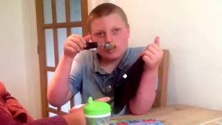 Angelman Syndrome  Samuel feeds himself very carefully [upl. by Geminius]