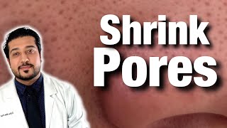 How to Shrink Pores For Good  Get Rid of Pores on Nose FAST 2021 [upl. by Rickard788]