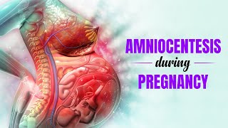 Amniocentesis during Pregnancy  What is it used for and its benefits  3D Guide [upl. by Kenton]