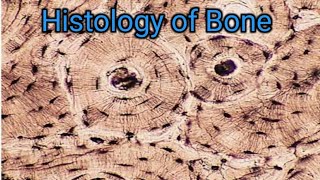 Histology of Bone [upl. by Edyth]