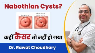 What is Nabothian Cyst  Symptoms of Nabothian Cyst  Homeopathic Treatment of Nabothian Cyst [upl. by Becki267]