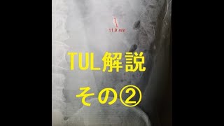 TUL ゆっくり解説動画②訂正版 [upl. by Elon944]