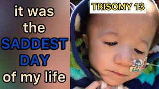 Trisomy 13 The day my son stopped smiling Trisomy 13 amp 18 13トリソミー [upl. by Netsud]