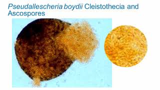 Identification of Melanized Dermatitiaceous Fungi Part 3 Hot Topic [upl. by Arman344]