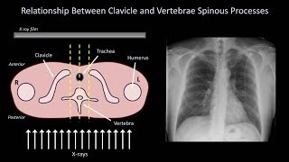 How to Interpret a Chest XRay Lesson 3  Assessing Technical Quality [upl. by Nievelt]