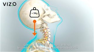 Extension cervicale Douleur au cou arthrose cervicale fourmillement dans les bras [upl. by Aldin]