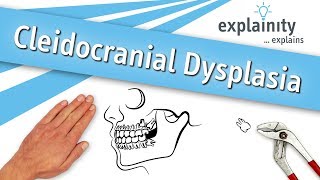 Cleidocranial Dysplasia explained explainity® explainer video [upl. by Tnairb]