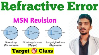 Refractive Errors  Hypermetropia  Myopia  Astigmatism  MSN Important Topic Eye MSN [upl. by Clorinde]