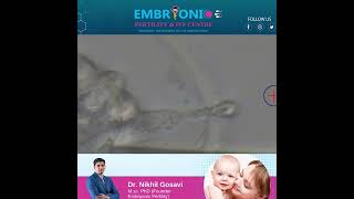 Trophectoderm Biopsy for PreImplantation Genetic Test Dr Nikhil Gosavi IVF Expert [upl. by Nagam]