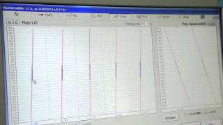 Volúmenes Pulmonares por Pletismografía corporal Prueba [upl. by Weaks660]