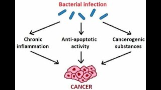 Microbial Carcinogenesis Oncogenic DNA viruses and Oncogenic RNA viruses [upl. by Doll]