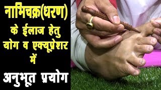 Naval Diplacement नाभिचक्र Nabhi Chakra धरण Naval का सटीक ईलाज Naval setting by yoga amp acupressure [upl. by Aloke]