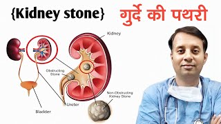 KidneyBladderProstaticUreteric Stone  Turp  turbt vvf  Dr Arawat Pushkarna  H R Talib Hussain [upl. by Chui13]