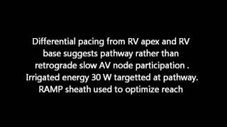 PJRT  Permanent Junctional Reciprocating Tachycardia [upl. by Ssej]