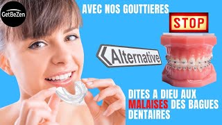 Gouttière dentaire pour alignement des dentspour avoir un joli sourire [upl. by Patman]