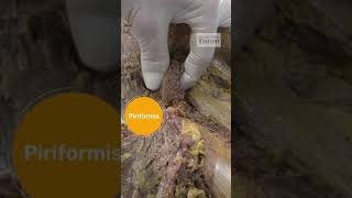 Piriformis Sciatic Nerve and Obturator Internus Anatomy [upl. by Hera]