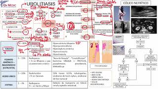 Urología  3 Urolitiasis 01 [upl. by Alexa]