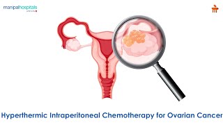 Hyperthermic Intraperitoneal Chemotherapy for Ovarian Cancer l Manipal Hospitals Bengaluru [upl. by Jaimie]