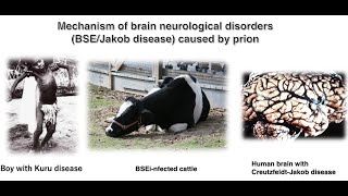 Mechanism of brain neurological disorders BSEJakob disease caused by prion proteins [upl. by Legra]