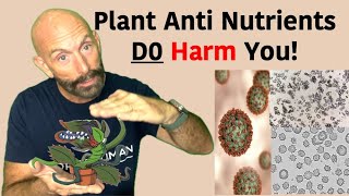 Are Plant AntiNutrients Harming You antinutrients oxalate [upl. by Ihskaneem]