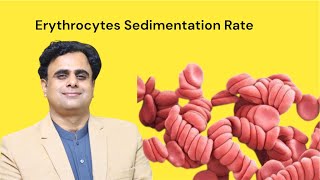 Erythrocytes Sedimentation Rate ESR [upl. by Junieta]