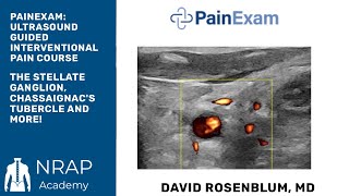 Ultrasound Guided Stellate Ganglion Chassaignacs Tubercle amp Interscalene Brachial Plexus [upl. by Skippy]