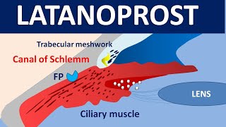 Latanoprost xalatan eye drops  Mechanism precautions side effects amp uses [upl. by Yatnod]