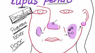 Lupus Pernio with a mnemonic [upl. by Aan]