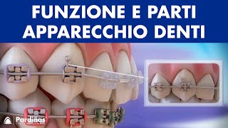 Ortodonzia  Funzione e parti apparecchio denti © [upl. by Lara]