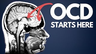 OCD explained for beginners  how I wish I was taught [upl. by Dario414]