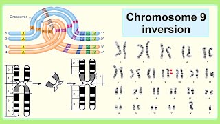 chromosome 9 inversion [upl. by Sparkie]