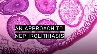 An approach to nephrolithiasis [upl. by Armstrong83]