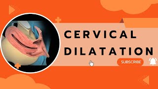 Cervical Dilatation [upl. by Guglielma]