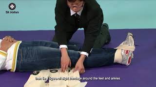 Bandaging Method For Thigh Bone Femur Fracture [upl. by Keli]