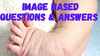 Image Based Questions  Child Health Nursing  Important Questions  Answers [upl. by Mazel684]