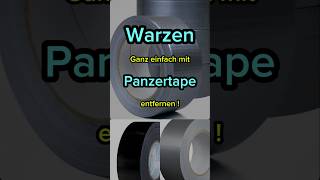 Warzen mit Panzertape entfernen gesundheit tips diy beauty fyp haut fürdich [upl. by Bernadine398]