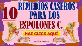 10 Remedios Caseros Para Los Espolones [upl. by Adolfo]