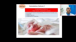 why extubation failure criteria for reintubation causes of extubation failuretime frame 24 72h [upl. by Aloz17]