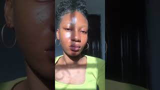 Cleansers For Acne Prone Skin skincareroutine asmr acneskincare acneproneskin [upl. by Oppen]