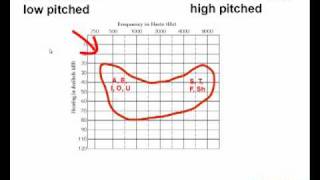 How to Read an Audiogram  Watch this Video Before You Buy Hearing Aids [upl. by Hui]