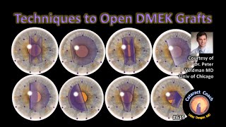 Techniques to Open DMEK grafts corneal endothelial transplantation [upl. by Merat]