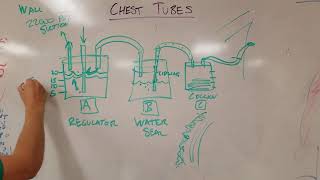 How Chest Tubes Work Tube Thoracostomies [upl. by Parhe]