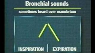 examination of the thoracic and respiratory system 5 [upl. by Creamer]