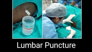 How to do Lumbar Puncture  How to do CSF study [upl. by Gusti]