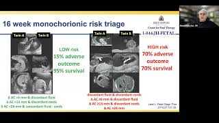 Management Guidance for Monochorionic Twin Pregnancies Webinar [upl. by Ettenom]