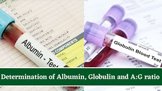 Determination Of Albumin and Globulin Total Protein Test And AlbuminGlobulin AG Ratio [upl. by Clarette]