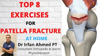 Top 8 Physiotherapy Exercises for Patella fracture Rehabilitation at Home  In Urdu Hindi [upl. by Anaeli]