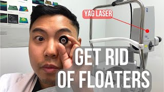 How to get rid of floaters in 2 MINUTES BUT IS IT SAFE  Ophthalmologist MichaelRChuaMD [upl. by Hastings]