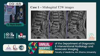 The Dynamic Positional MRI of the Lumbosacral Spine Would it Change The Taken Decision [upl. by Freed59]