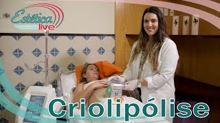 A Verdade sobre a Criolipólise [upl. by Yerxa]